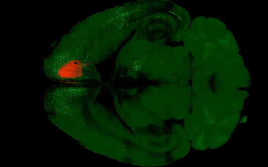 Scientists Have Just Mapped Exactly How Psilocybin Rewires Your Brain, And It's Not What They Expected